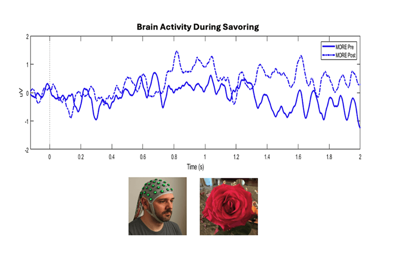 Brain Activity Chart