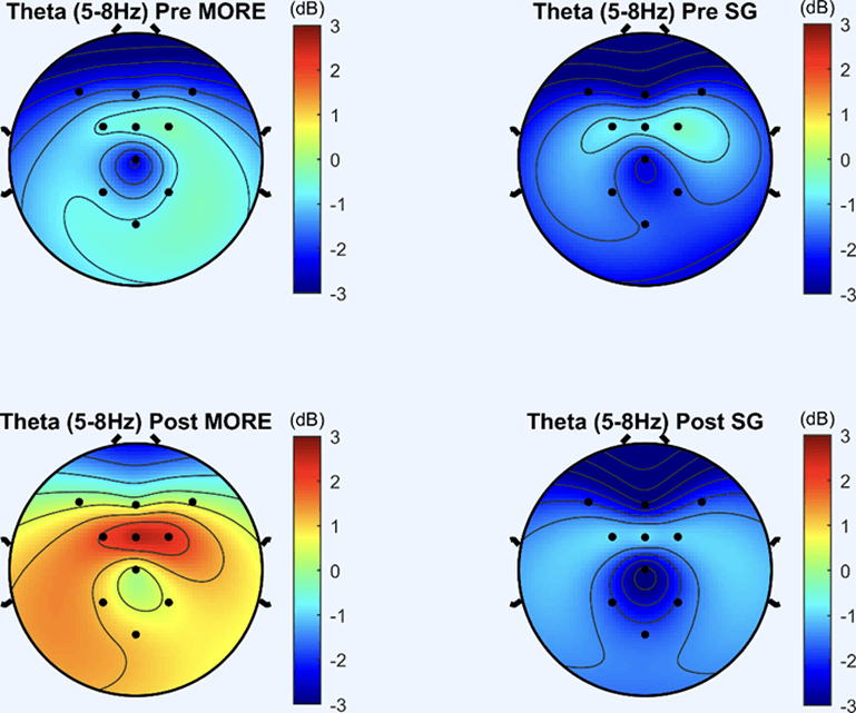 Theta Wave Chart